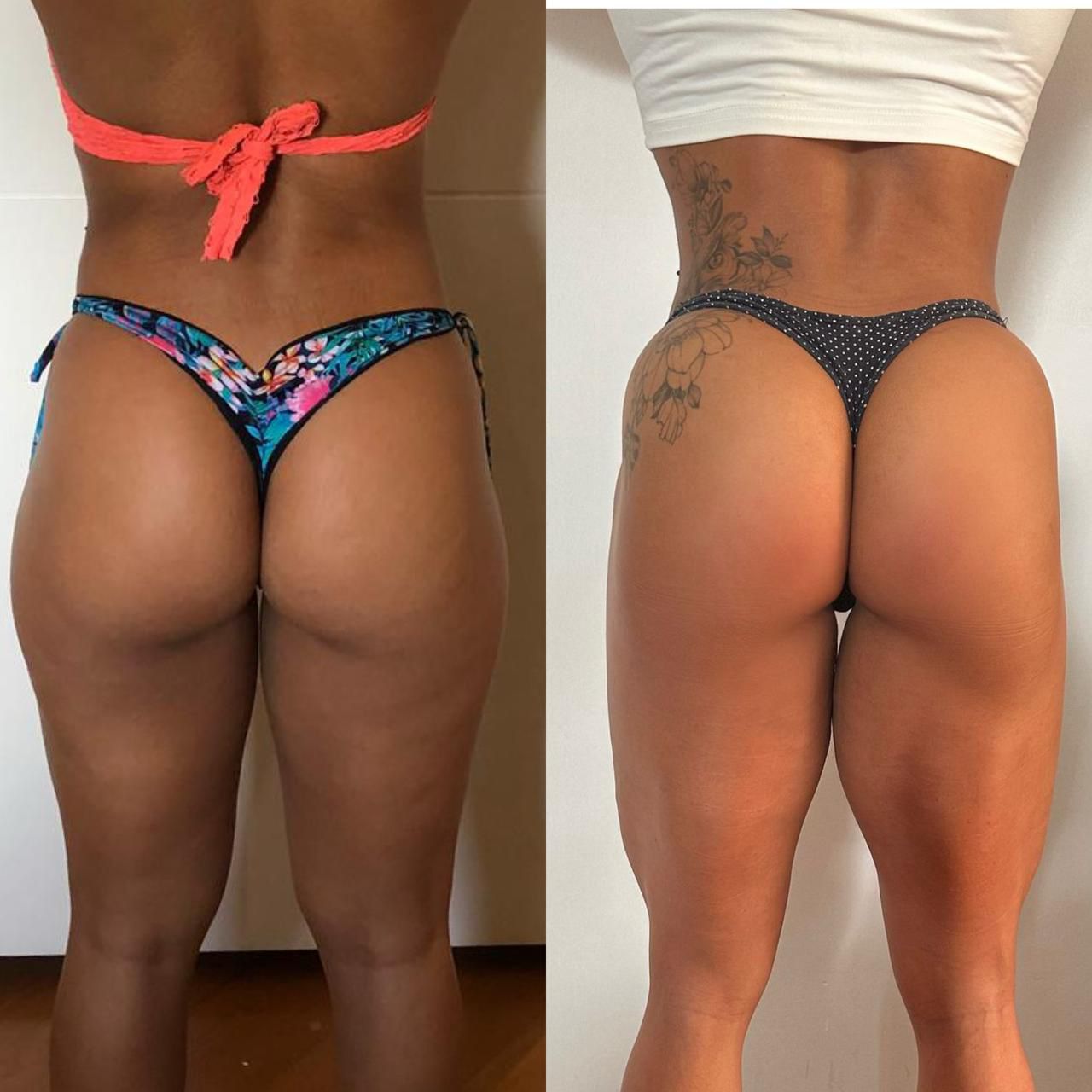 Resultado antes e depois Protocolo BR