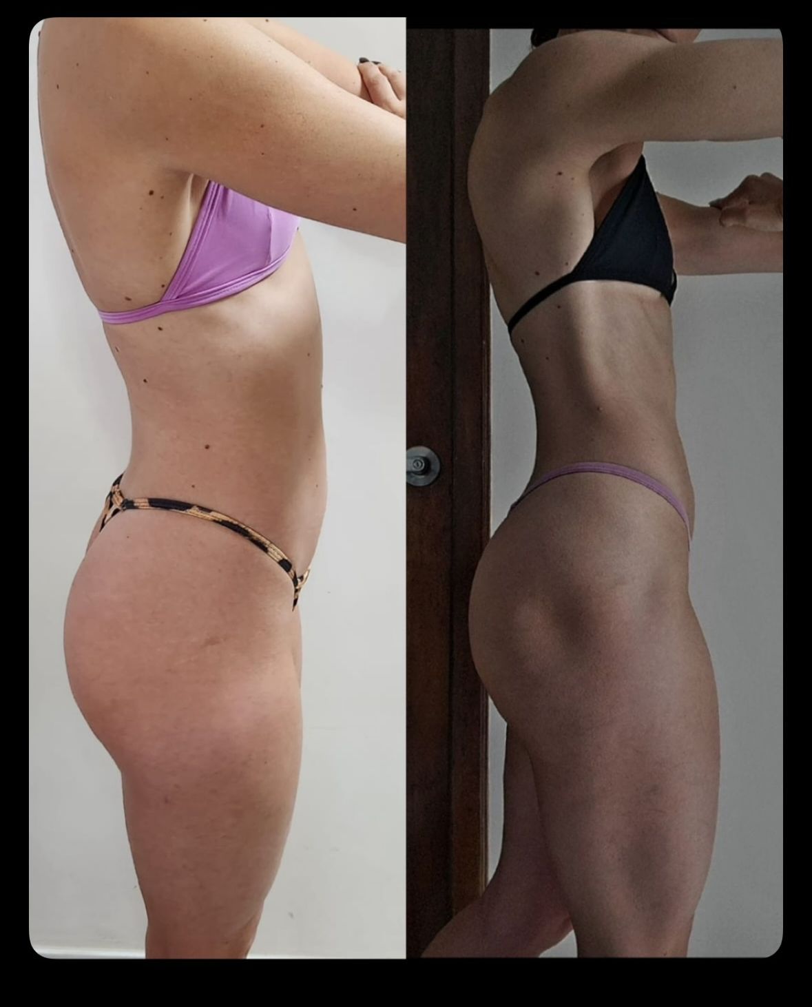 Antes e depois Protocolo BR
